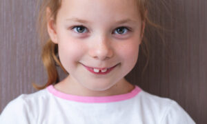 Blond child with projecting upper front teeth